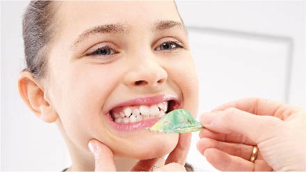 Kids Braces