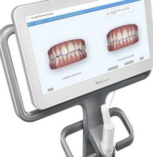 INvisalign-andover